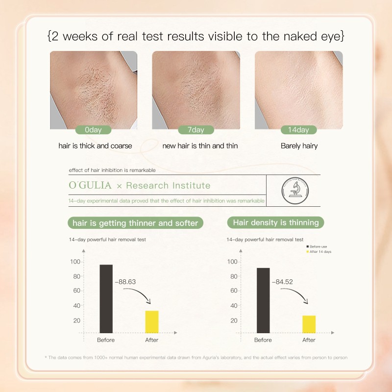 OEM 250g Instant Hair Removal Cream for Face Gentle Natural Private Area Hair Inhibiting Growth for Men Women Sensitive Skin