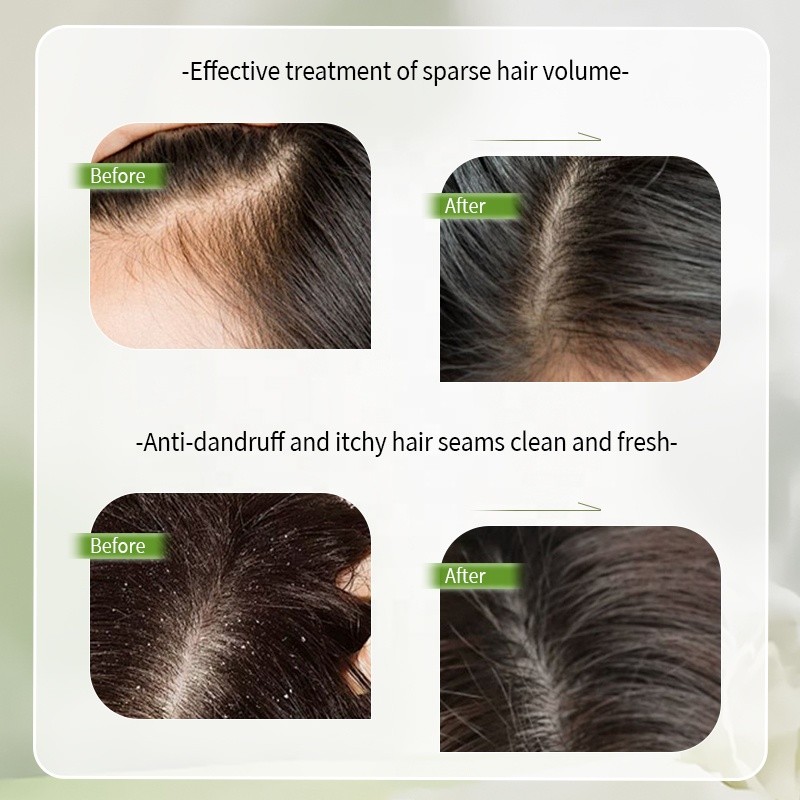 Private Label Biotin Amino Acid Shampoo 500ml/16.9fl oz for Hair Growth Shine Deep Repair Nourishing Hair Strengthening Shampoo