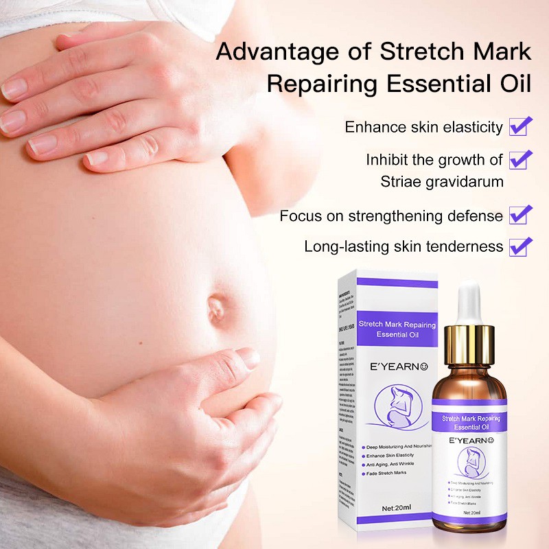 Maternity Stretch Marks Removal Oil Body Buttock Breast Mark Skin Care Effective Anti White Stretch Scar Remover Oil
