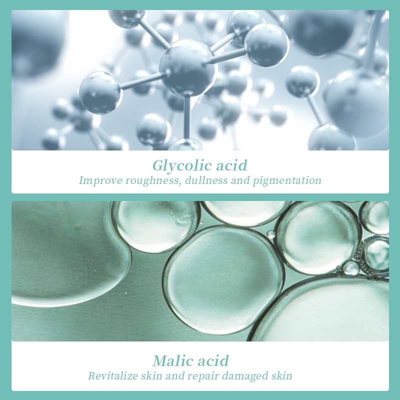 OEM Alpha Hydroxy Acid Serum 30ml Exfoliating Blackhead Removal Solution Natural Pore Cleaning Essence Anti-Acne Face Serum