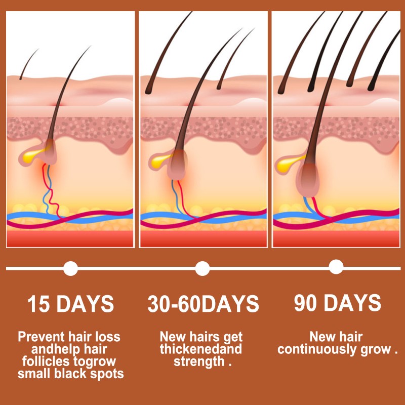 OEM High-Efficient Hair Growth Oil Ginseng Scalp Oil Anti-Hair Loss Scalp Nourishing Serum for Thicker Fuller Hair Treatment