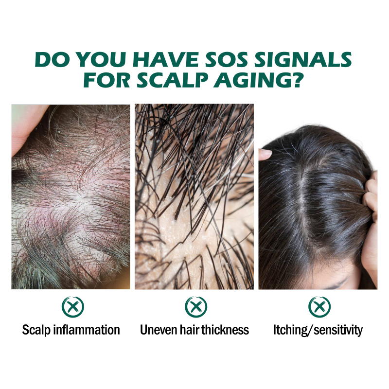 EELHOE Herbal Peppermint Scalp Care Oil Deep Cleansing Nourishing Skin Care Oil for Damaged Dry Curly Hair Smoothing Feature