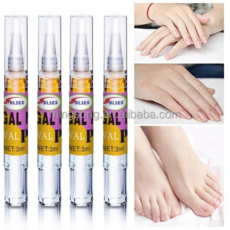 Private Label Best Nail Fungal Treatment,Nail Restoring Solution for Toenail & Fingernail Fungus