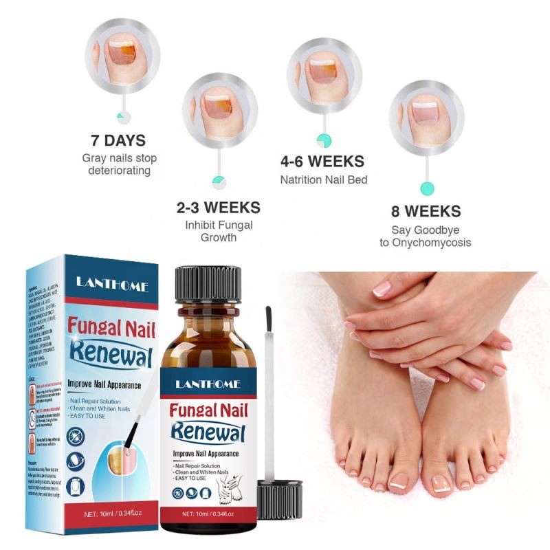 Easy to Use Improve Nail Appearance Finger Repair Solution Foot Fungus Infection Treatment for Ingrown Toe Nail