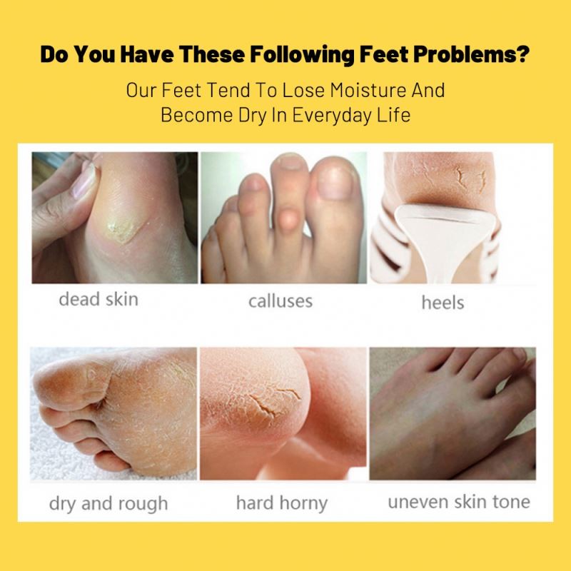 40g Natural Foot Moistourizing Exfoliating Banana Nourishing Foot Peel Mask Sheet