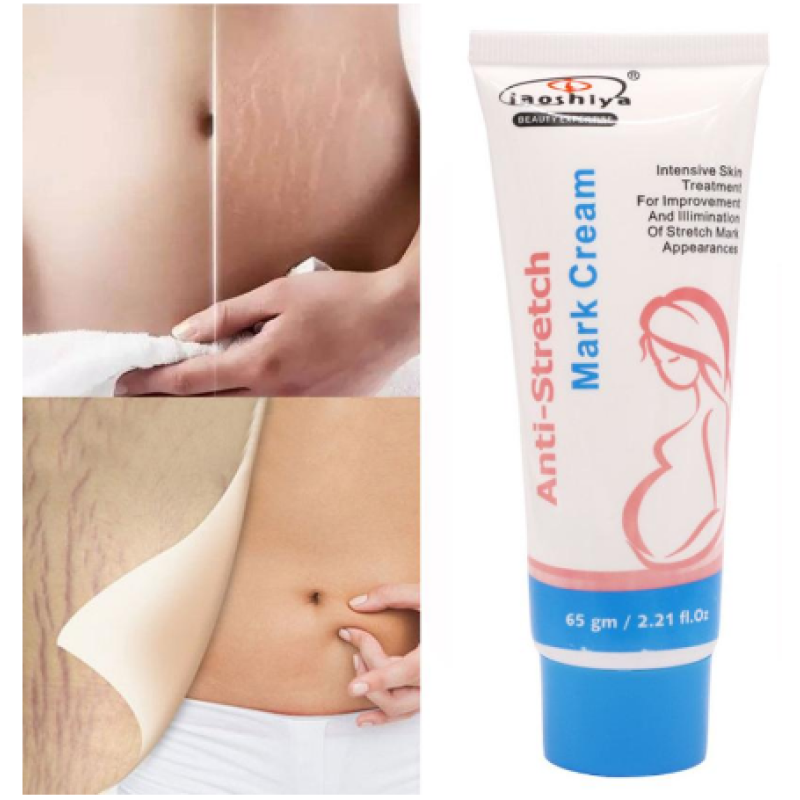 2019 New Style Removal Acne Scar Stretch Marks Cream Fat Scar Striae Gravidarum Treatment
