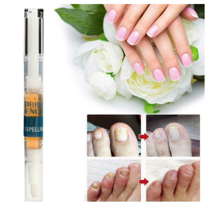 Anti Fungal Treatment Nail Pen Repair Gel 3ML Onychomycosis Paronychia Infection Herbal Toe Finger Nails Health Care