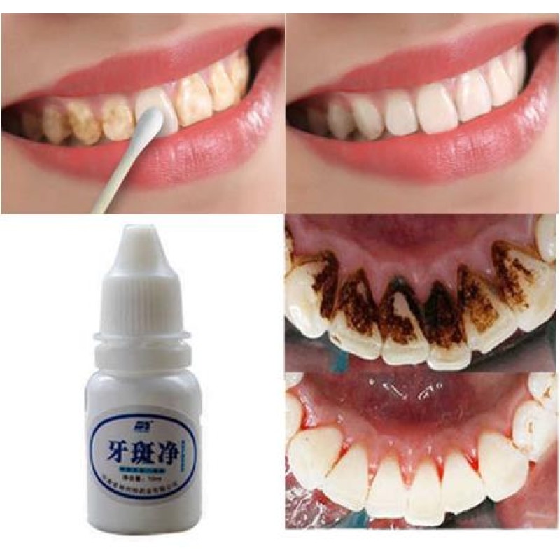 Teeth Whitening Water Oral Hygiene Cleaning Tartar Smoke Stains Tea Stains Tooth Stones Remover Nature Feature OEM Available