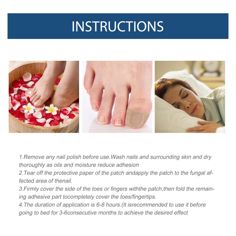 OEM Wholesale Transparent Nutrient Fungal Nail Repair Patch Moisturizing Gray Nail Repair Protects Cortex Nail Supplies