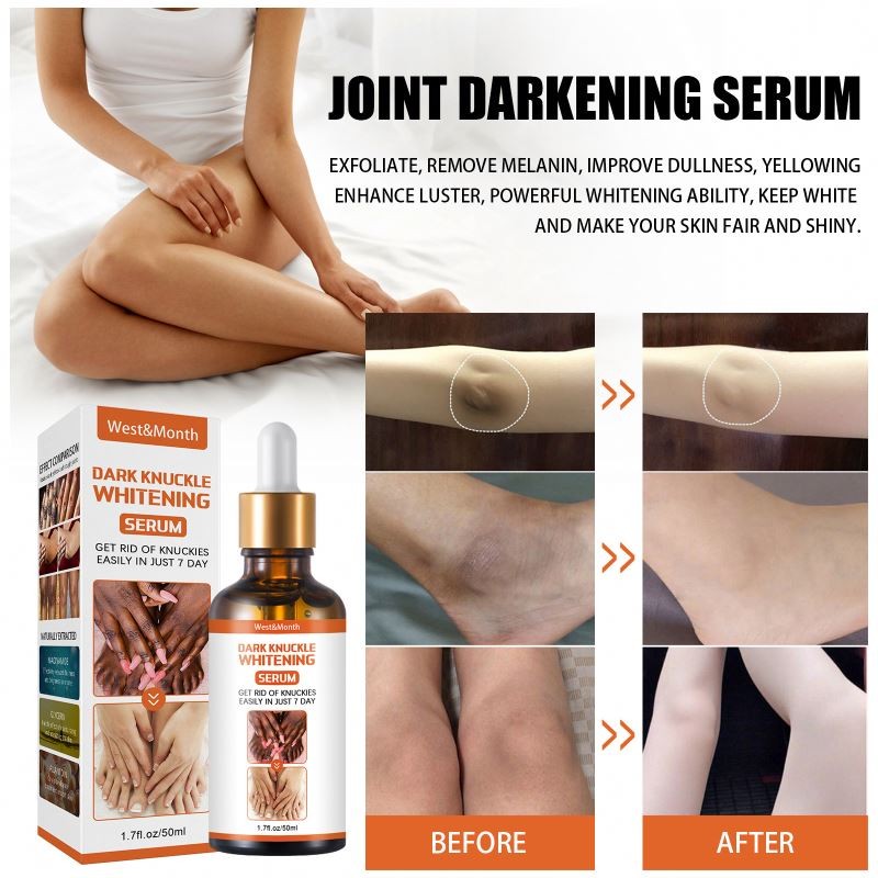 2022 Strong Whitening Serum for Body Dark Knuckles Elbow and Knee 50ml Liquid Form Whitening Finger Removal