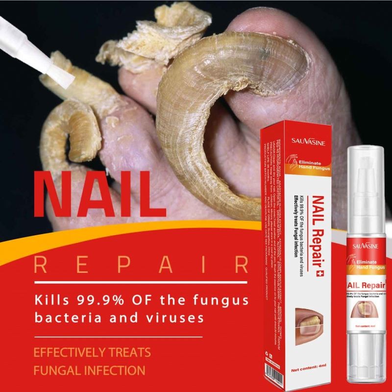 7 DAYS Care Hand and Feet Foot Care Removal Repair Gel Anti Infection Toenail Fungus Treatment Essence Serum Nail Fungus Pen