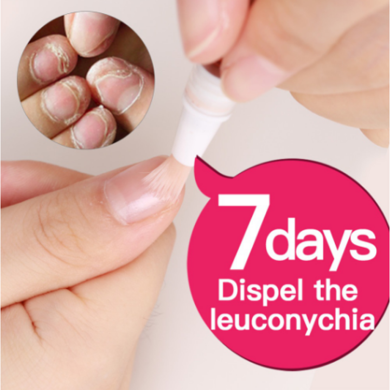 Nail Fungus Repair Treatment Pen Products Onychomycosis Paronychia Anti Fungal Nail Infection Chinese Herbal Care Oil Pen