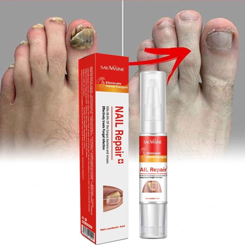 7 DAYS Care Hand and Feet Foot Care Removal Repair Gel Anti Infection Toenail Fungus Treatment Essence Serum Nail Fungus Pen