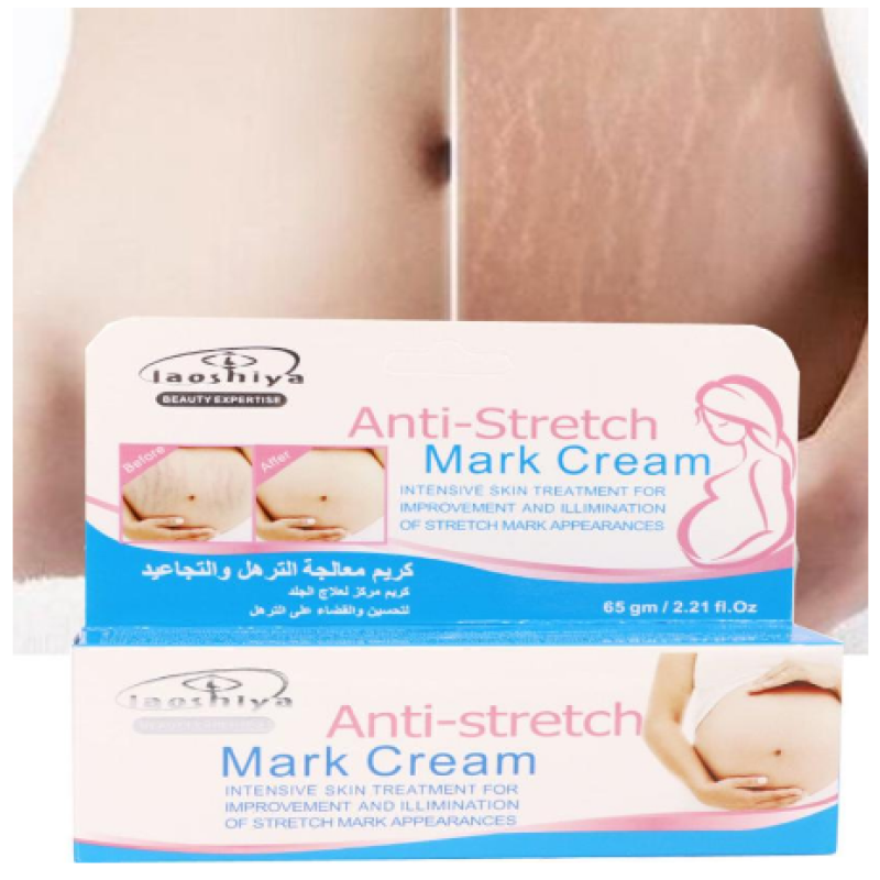 2019 New Style Removal Acne Scar Stretch Marks Cream Fat Scar Striae Gravidarum Treatment
