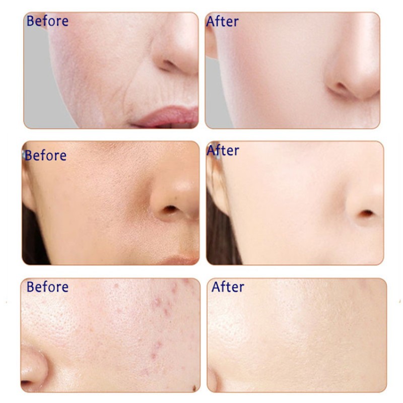 2019 Best Selling Snail Essence Moisturizing Facial Skin Care Whitening Hydrating Oil Control Blackhead Remover Face Masks