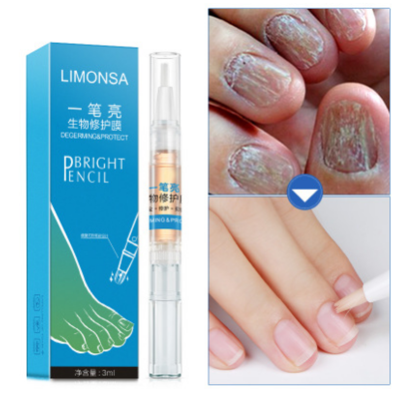 Anti Fungal Treatment Nail Pen Repair Gel 3ML Onychomycosis Paronychia Infection Herbal Toe Finger Nails Health Care