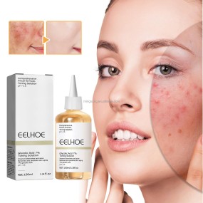 Glycolic Acid 7% Toner, Acne Removing, Mouth Closing, Moisturizing, Pore Shrinking, Skin Brightening Essence