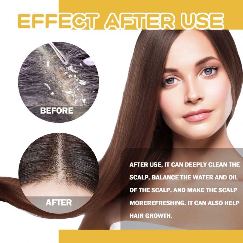 OUHOE 60g Deep Cleansing Polygonum Ginger Soap Shampoo Bar Anti-Dandruff Refreshing Nourishing Anti Hair Loss