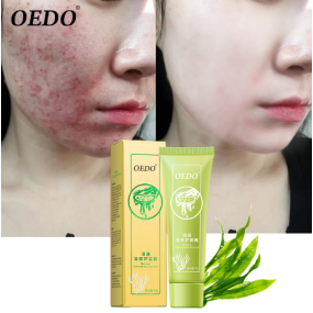 Seaweed Aloe Vera Gel Facial Cream with Glycerin Hydrating Whitening Day Cream for Acne Collagen Brightening Skin Care