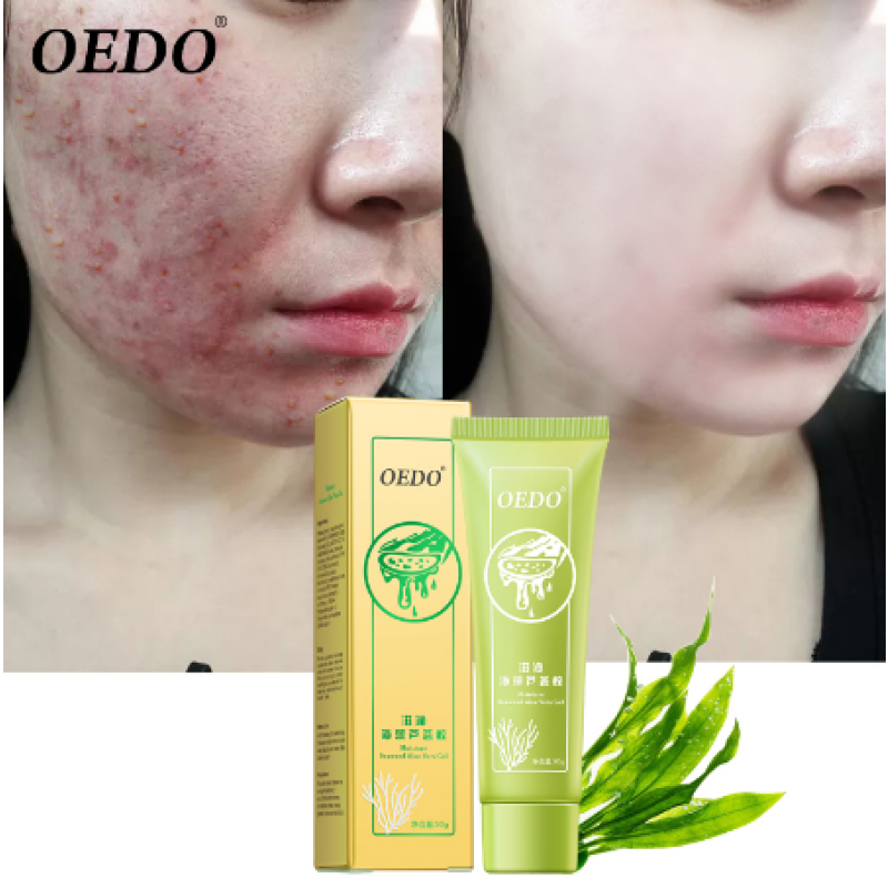 Seaweed Aloe Vera Gel Facial Cream with Glycerin Hydrating Whitening Day Cream for Acne Collagen Brightening Skin Care