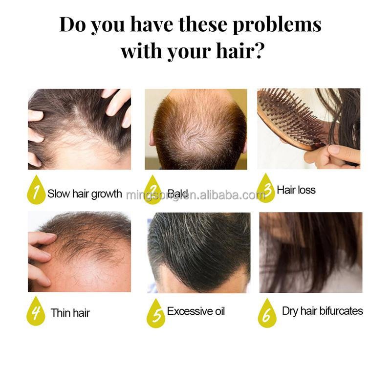 EELHOE Hair Growth Longsheng Rice Soap Scalp Cleansing Nourishing Bald Hair Loss Breakage Bifurcate Repairing Handmade Soap