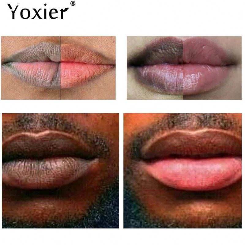 Yoxier 20g Cosmetics Moisturizing Brightening Remove Dull Lip Scrub for Dark Lips