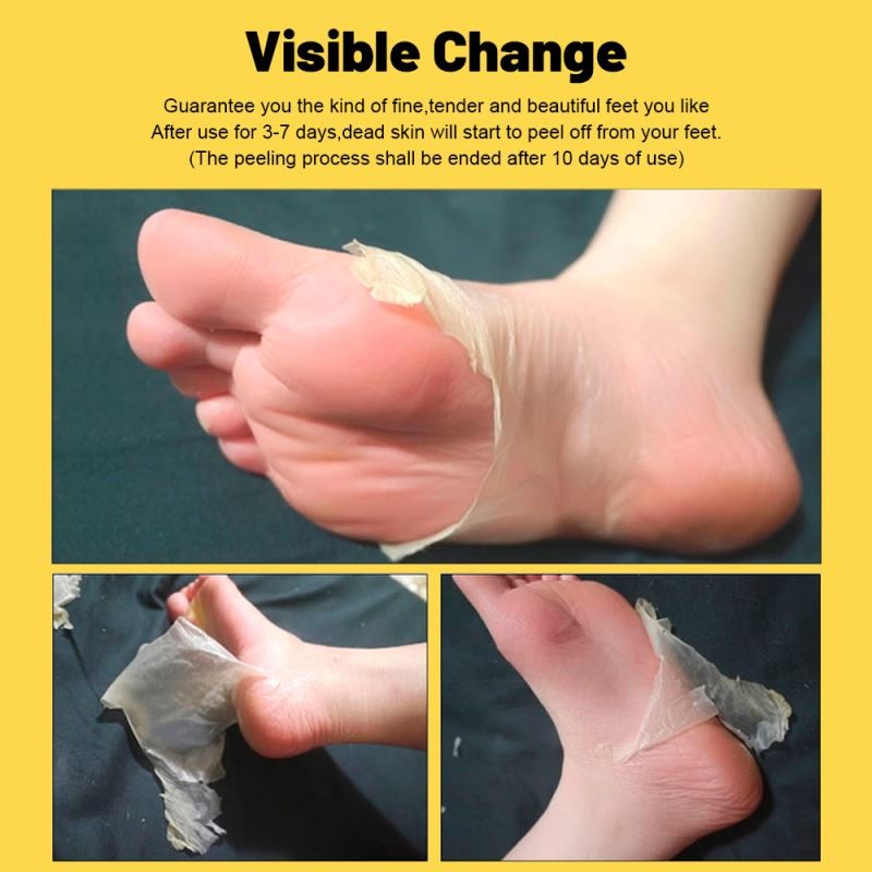 40g Natural Foot Moistourizing Exfoliating Banana Nourishing Foot Peel Mask Sheet