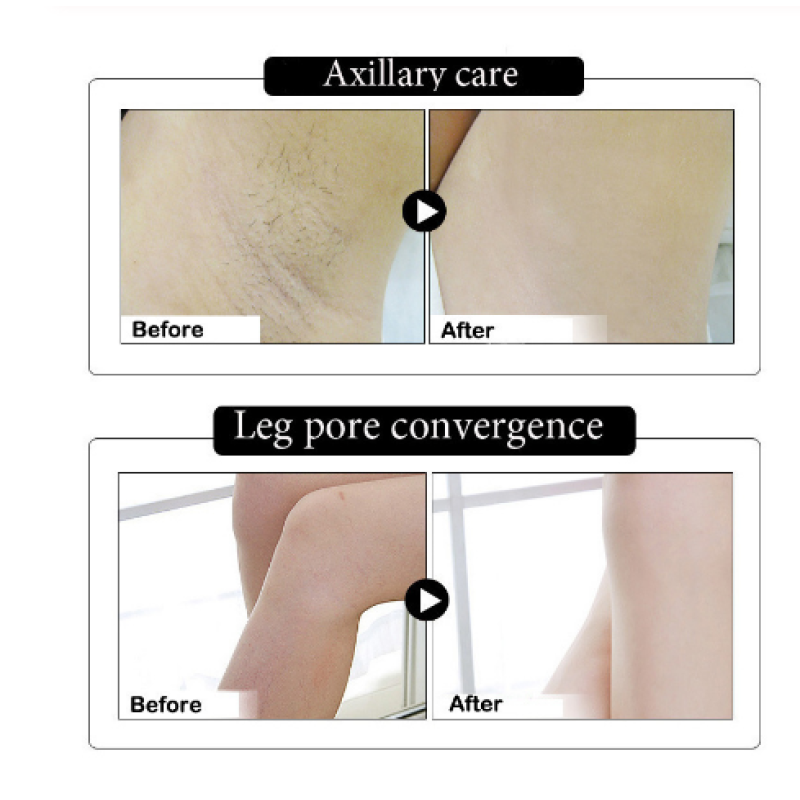 Body Whitening Cream Underarm Whitening Cream Armpit Whitening Cream Legs Knees Private Parts Cosmetics Skin Care