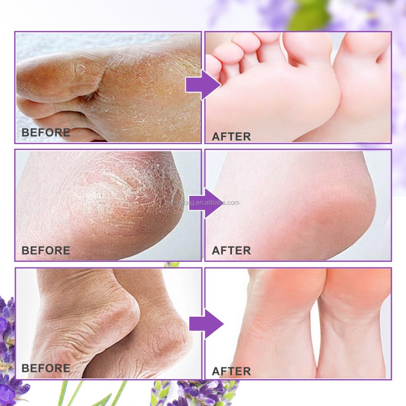 Private Label Pure Nature Lavender Crystal Jelly Spa Pedicur Foot Soak DIY Foot Jelly Spa Soften Whitening Foot Peeling Mask