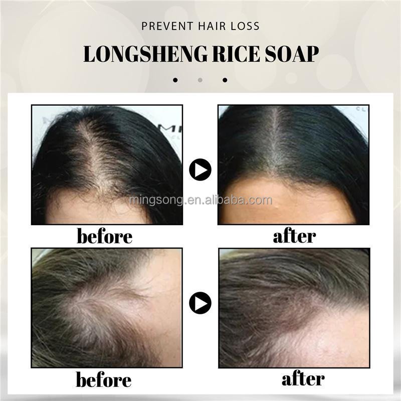 EELHOE Hair Growth Longsheng Rice Soap Scalp Cleansing Nourishing Bald Hair Loss Breakage Bifurcate Repairing Handmade Soap