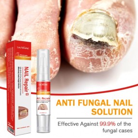 7 DAYS Care Hand and Feet Foot Care Removal Repair Gel Anti Infection Toenail Fungus Treatment Essence Serum Nail Fungus Pen