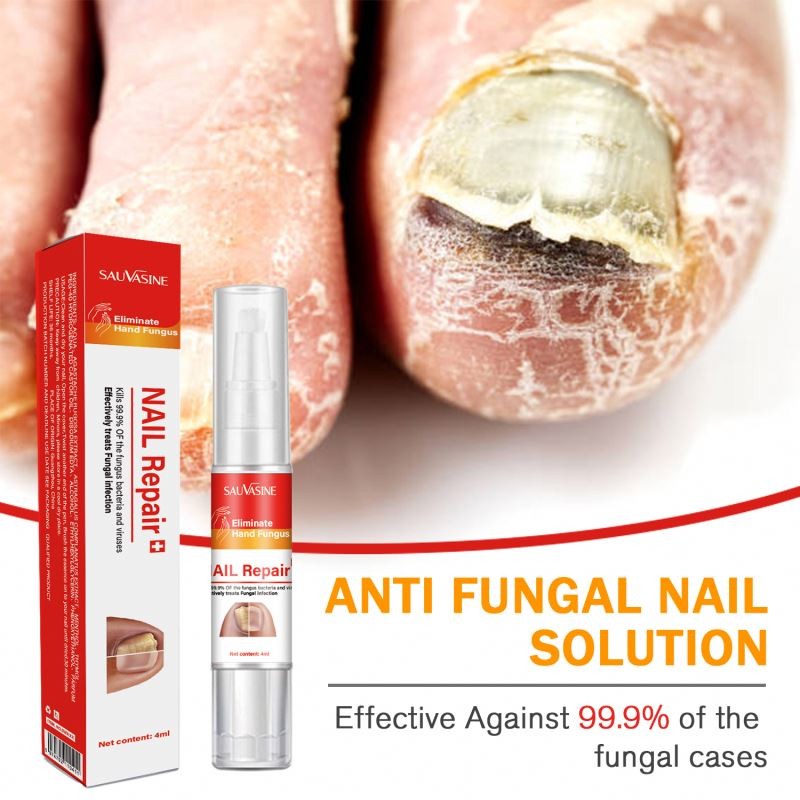 7 DAYS Care Hand and Feet Foot Care Removal Repair Gel Anti Infection Toenail Fungus Treatment Essence Serum Nail Fungus Pen