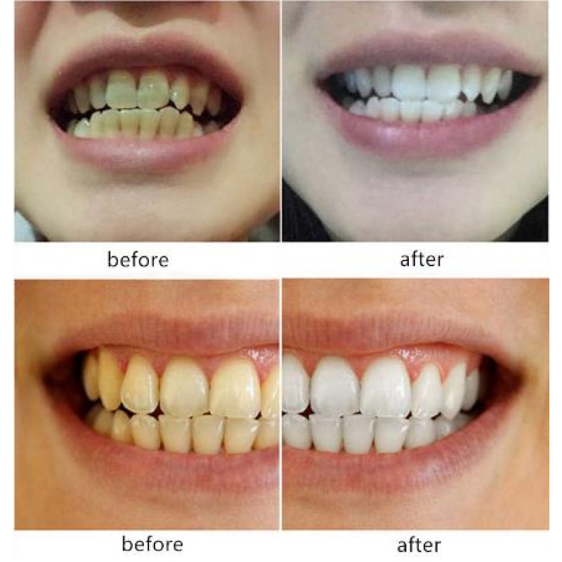Teeth Whitening Water Oral Hygiene Cleaning Tartar Smoke Stains Tea Stains Tooth Stones Remover Nature Feature OEM Available