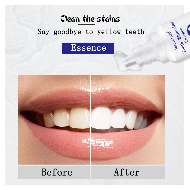 Wholesale Teeth Whitening Oral Hygiene Cleaning Serum Remove Plaque Stains Tooth Bleaching Tools Dental Care Toothpaste