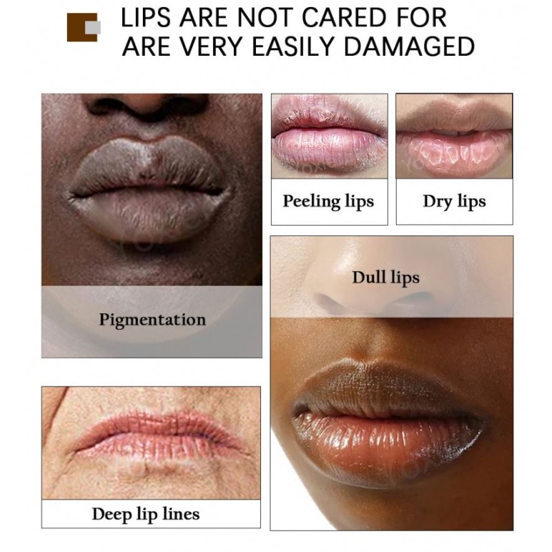 Yoxier 20g Cosmetics Moisturizing Brightening Remove Dull Lip Scrub for Dark Lips