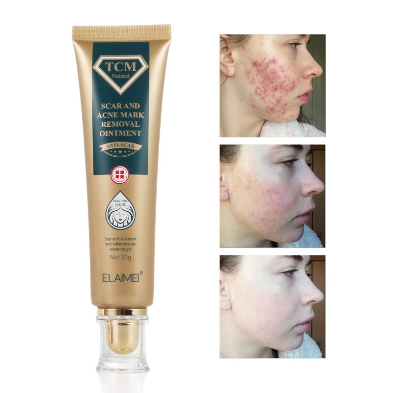 Acne Treatment Scar Removal Face Cream Skin Care Whitening Cream for Body Nourishing and Repair Scars
