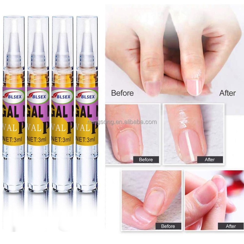 Private Label Best Nail Fungal Treatment,Nail Restoring Solution for Toenail & Fingernail Fungus