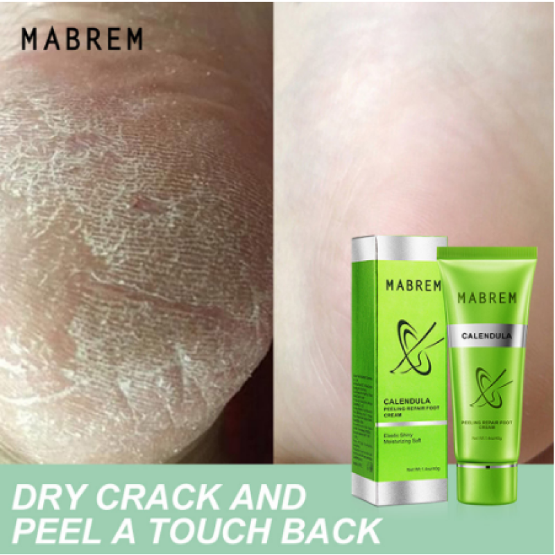 MABREM Foot Care Cream Long-Lasting Soft Rough Skin Moisturizing Foot Charm Calendula Soft Moisturizing Foot Cream