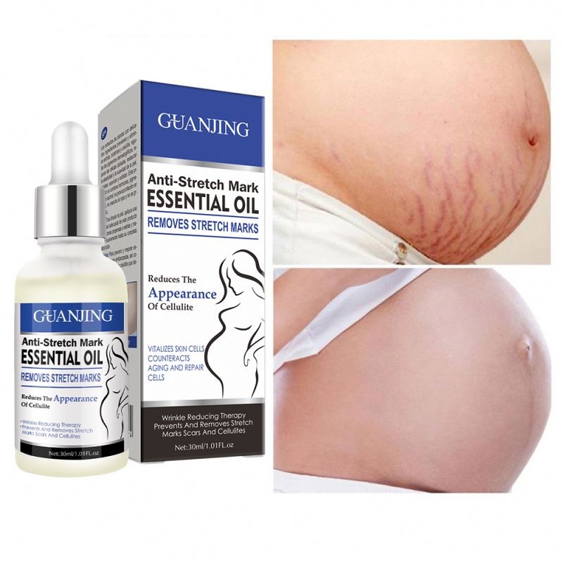 Anti-Stretch Marks Pure Essential Oil 30ml Counteracts Aging & Repair Cells Stretch Mark Remover