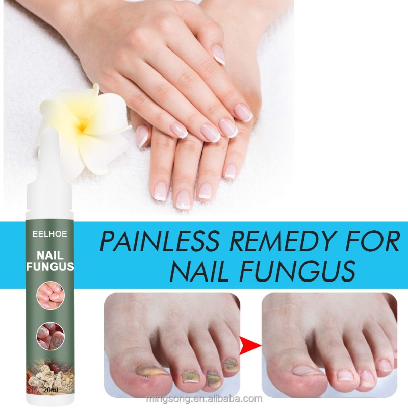 Factory Direct Radiance 100% Natural Antifungal Nail Treatment Toenail Fungus Quick Repair Cost-effective Fungal Nail Serum 20ml
