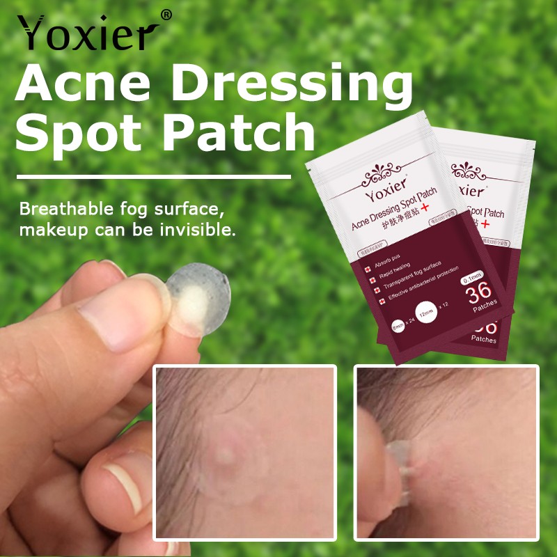 36pcs Acne Dressing Spot Patch Pimple Remover Tool Set Face Cream Skin Care Blemish Treatment Invisible Acne Stickers
