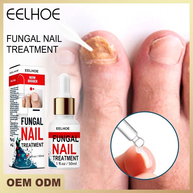 Eelhoe Repair Nail Smoothing Essence Onychomycosis Liquid Nails Press on Polish