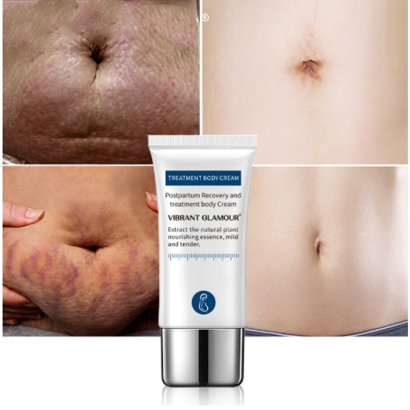 Crocodile Stretch Marks Remover Cream Ance Maternity Repair Anti Aging Winkles Firming Body Care Pregnancy Scars