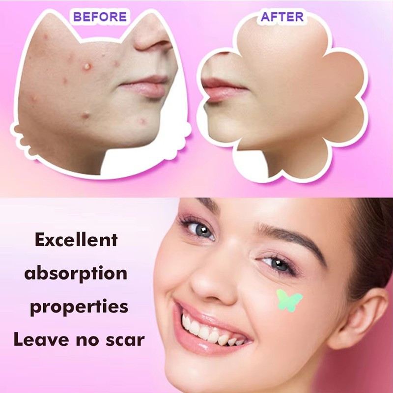 Factory Customization Acne Patch Pimple Acne Patch Skin Care Transparent Patch