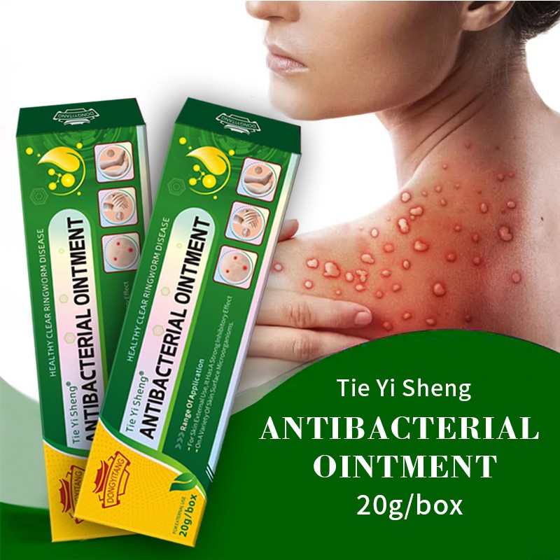 Factory Supply Local Skin Infection Eczema Cream Skin Antipruritic Cream