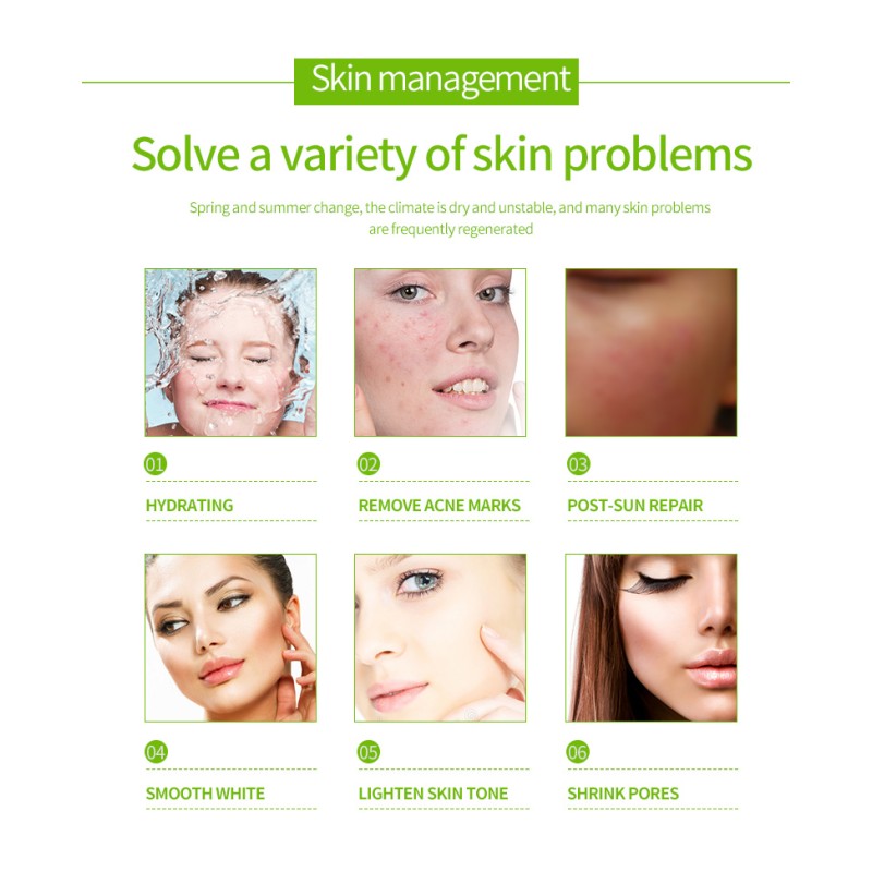 Private Label Acne Skin Cream Herbal Plant Formula Aloe Moisturizer Acne Cream