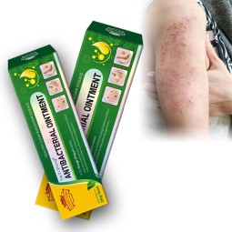 Factory Wholesale Topical Eczema Cream Skin Itching Jock Itch Ointment