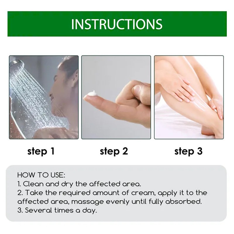 Factory Sales Herbal Antipruritic Cream Eczema Urticaria Alergy Skin Ointment