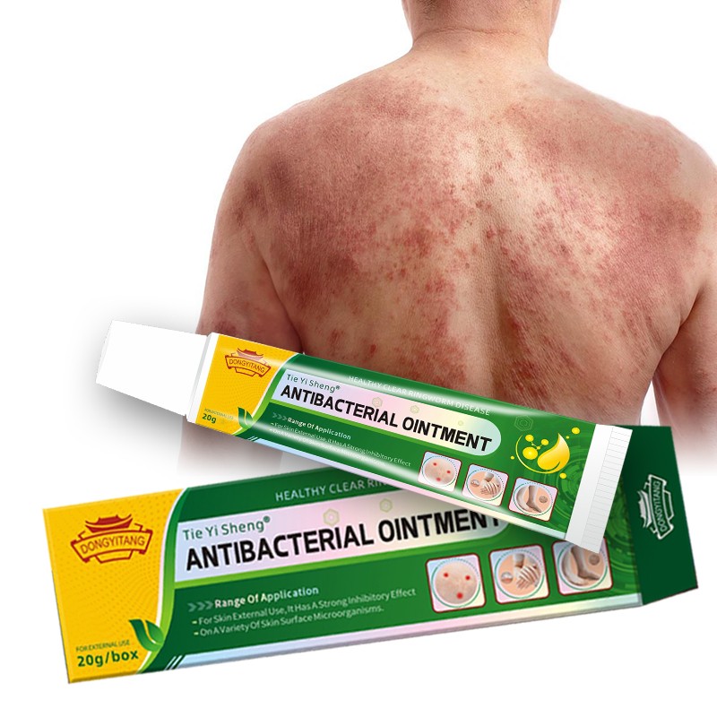 Wholesale Custom Herbal Skin Ringworm Cream Skin Eczema Itching Acne Fungal Infection Ointment
