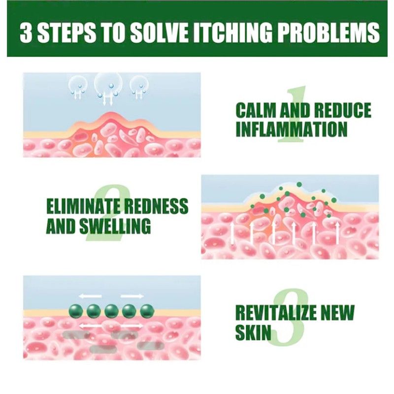 Topical Skin Infection Care Cream Skin Itching Eczema Soothing Balm